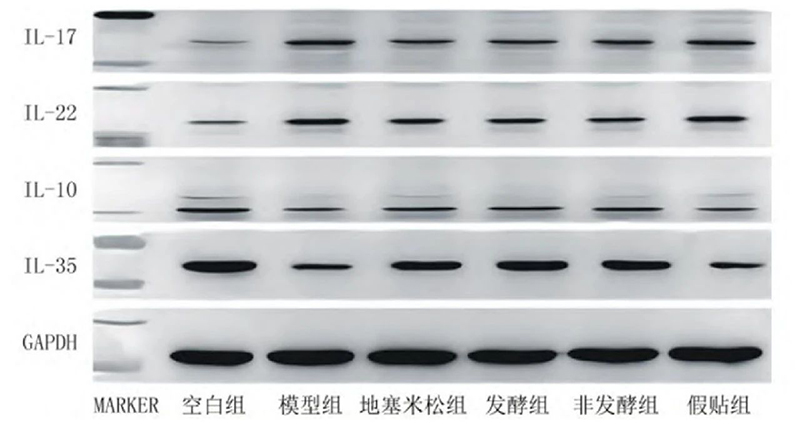 空白組和支氣管哮喘各組大鼠肺組織中IL-17、IL-22、IL-10、IL-35蛋白表達電泳圖